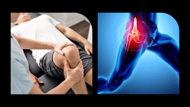 knee-pain-clicking-weak-glutes-hip-exercises.webp